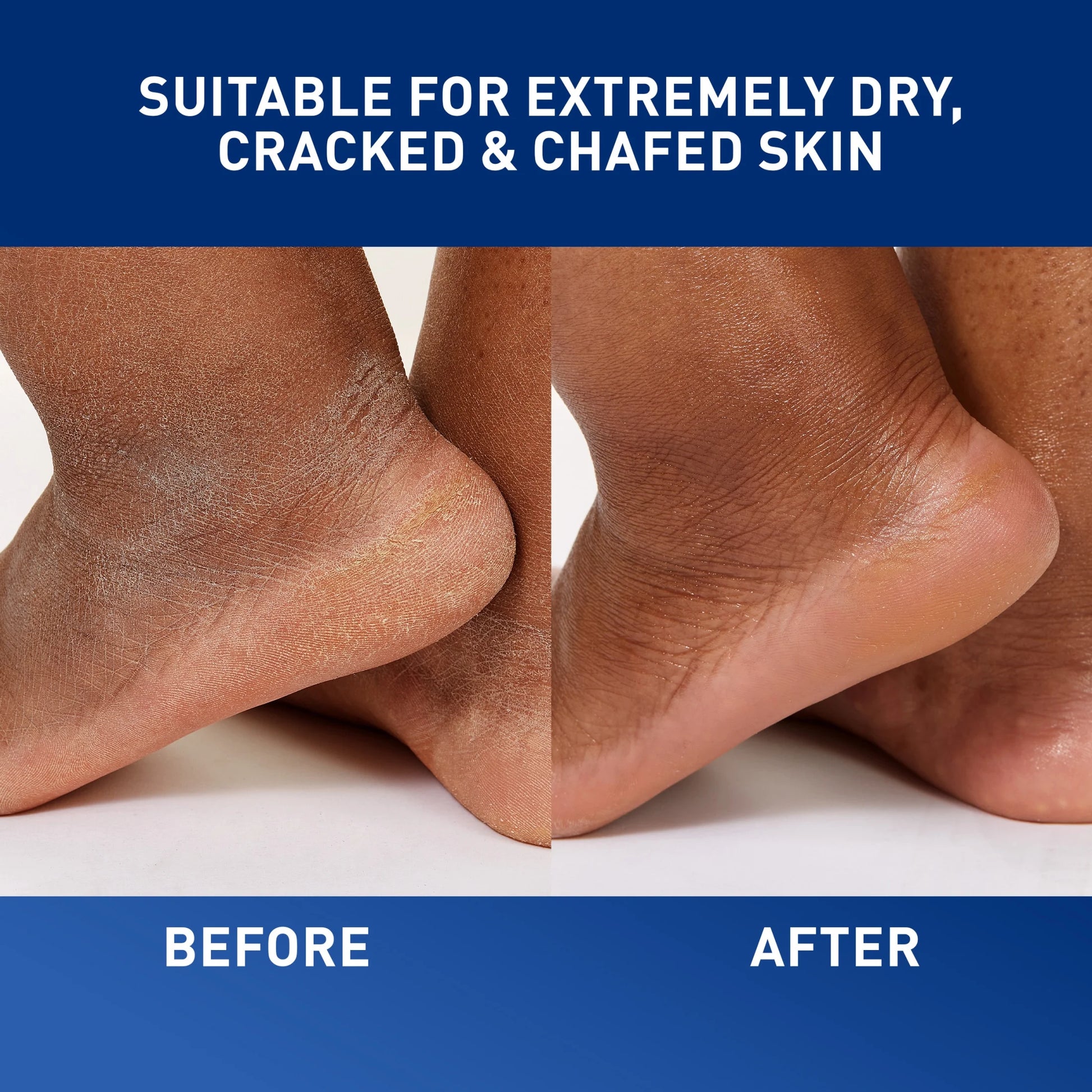 Healing Ointment for Face & Body, Protects and Soothes Dry, Cracked, & Chafed Skin 12 Oz